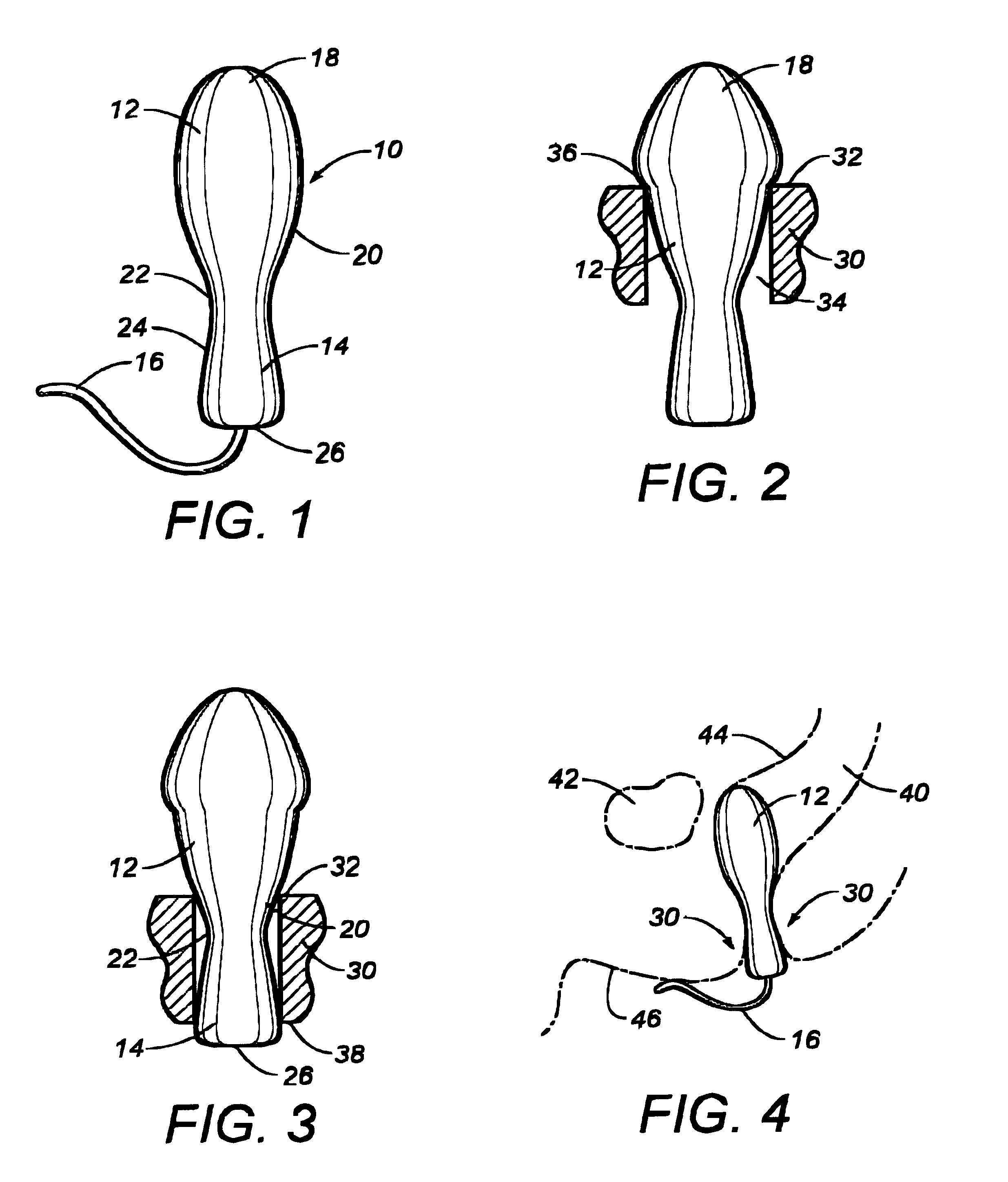Aneros Predecessor Patent Pics 